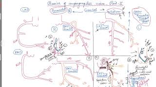 Coronary artery anatomy  Coronary angiogram [upl. by Tsugua]