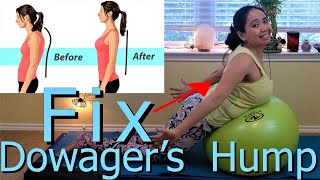 Improve Posture For Dowagers Hump 3 Best Pilates Exercises [upl. by Lisa]