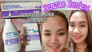 Benzac  Benzoyl Peroxide Review Benzac AC Wash 5 and Spots Treatment 10 [upl. by Nodnnarb65]