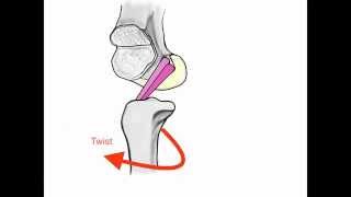 ACL Anatomy [upl. by Ali817]