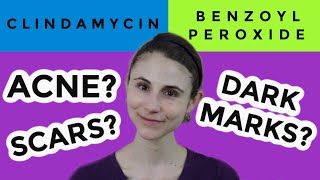 Clindamycin versus benzoyl peroxide for acne Dr Dray [upl. by Sihonn]