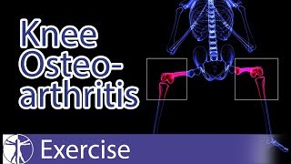 Osteoporosis Exercises for Hip Strengthening [upl. by Ennylyak]