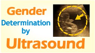 Gender Determination by Ultrasound [upl. by Yate]