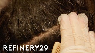 I Got A Scalp Facial To Treat Dandruff  Macro Beauty  Refinery29 [upl. by Hirst566]