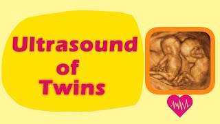 Sonography of Twins [upl. by Brunhilda263]