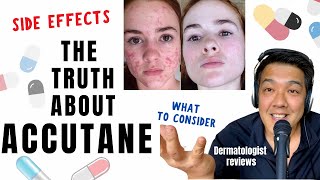 ACCUTANE  Dermatologist Review Unbiased [upl. by Irollam408]