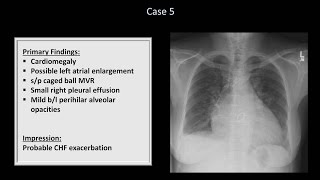 How to Interpret a Chest XRay Lesson 10  Self Assessment Part 1 [upl. by Thorvald603]