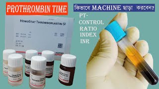 Prothrombin Time Test  PT INDEX INR [upl. by Elhsa728]