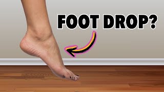 Top 3 Exercises For Foot Drop [upl. by Laban251]