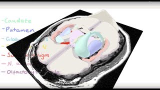 Basal Ganglia 3D Tour [upl. by Nonrev]