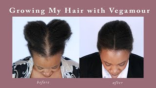 Vegamour Gro Advanced Hair Serum Results [upl. by Suitangi]