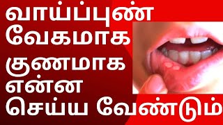 வாய் புண் வேகமாக குணமாக  vaai pun treatment in tamil  Mouth Ulcer Treatment [upl. by Ellicott532]