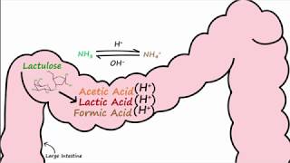 Hepatic Encephalopathy and Lactulose [upl. by Maguire]