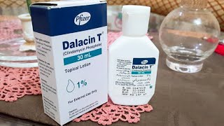 Dalacin T Lotion for acne Review usage Benefit Price Remove Pimples acne best solution for acne [upl. by Kimmel]