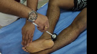 Deep Tendon Reflexes clinical examination by Dr Gireesh Kumar KP [upl. by Mattie522]