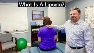 What Is A Lipoma [upl. by Sirrah]