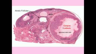 Ovarian Cyst Causes Symptoms and Treatment [upl. by Nythsa]