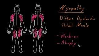 Myelopathy  Patient Education [upl. by Ydac]