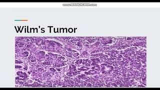 Mucinous Cystadenoma Ovary  Histopathology [upl. by Ameerak]