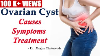 What You Need to Know About Ovarian Cysts [upl. by Lenka]