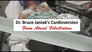 Dr Bruce Janiaks Cardioversion from Atrial Fibrillation [upl. by Harahs]