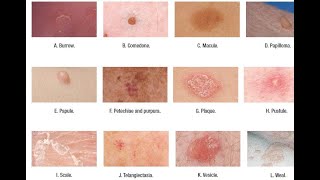 Skin Lesions with defination [upl. by Hasina]