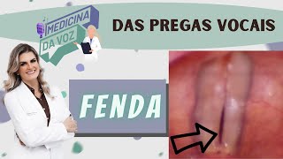 Fenda de cordas vocais [upl. by Priscella]