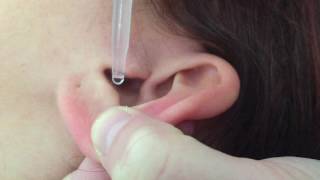 how to use ear drops [upl. by Jake]