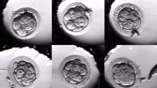 IVF PROCESS STEP BY STEP In Vitro Fertilisation Embryo cultivation [upl. by Arayt]