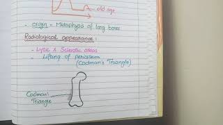 Osteosarcoma Pathology [upl. by Casper]