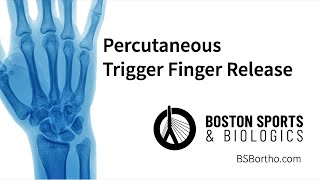 How to Heal Trigger Finger with 4 Exercises That Work Real Patient [upl. by Oneil]