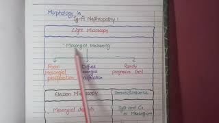 IgA Nephropathy  Pathology [upl. by Tal382]