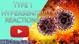 Type I hypersensitivity IgEmediated hypersensitivity  causes symptoms pathology [upl. by Eelyek979]