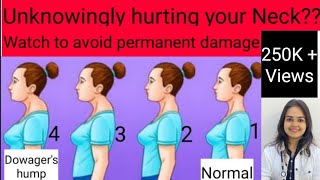 How to get rid of Neck hump Dowagers humpBuffalo hump in hindi  How to cure hump on back of neck [upl. by Matta]