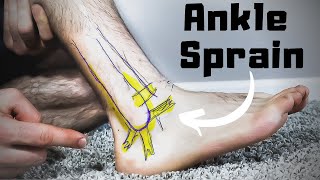 Twisted or Rolled Ankle Sprain Treatment FASTER Home Recovery Time [upl. by Canale]