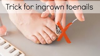 How to Fix Ingrown Toenails Easily [upl. by Navannod442]