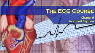 Arrhythmia overview  Types  Diagnosis and treatment [upl. by Ayeki]