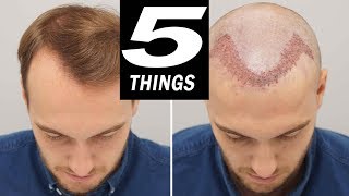 5 THINGS to do after HAIR TRANSPLANT [upl. by Monika877]