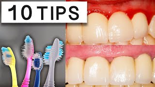 10 Tips To Reduce Swollen Gums At Home [upl. by Hans]