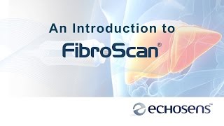 A Patients Introduction to FibroScan [upl. by Vano]