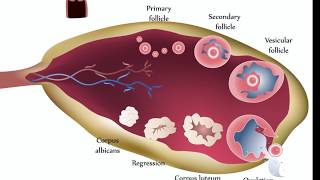 Ovarian Cysts [upl. by Richel]