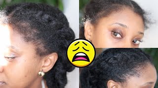 😩MY EDGES BROKE OFF Lets try The Ordinary Hair Serum  Natural hair [upl. by Zins173]