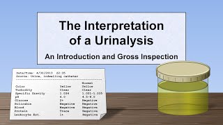 Interpretation of the Urinalysis Part 1  Introduction and Inspection [upl. by Tigges]