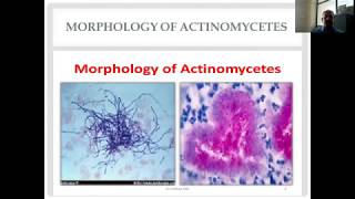 Actinomycetes and Nocardia Diverse Group of Gram Positive Bacilli [upl. by Aja]