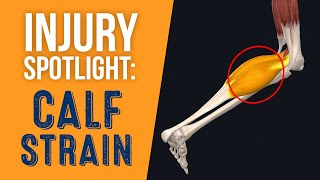 Injury Spotlight Calf Strain [upl. by Bergeman]