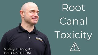 Root Canal Toxicity Everything You Need to Know About Root Canals [upl. by Alyahsat]