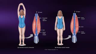 Causes of Muscle Soreness  Coursera Science of Exercise [upl. by Carberry687]