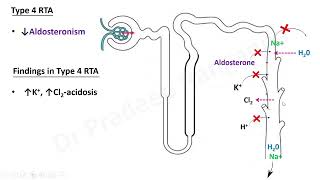 RTA Renal Tubular Acidosis [upl. by Assecnirp]