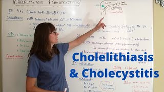 Cholelithiasis amp Cholecystitis [upl. by Camroc]